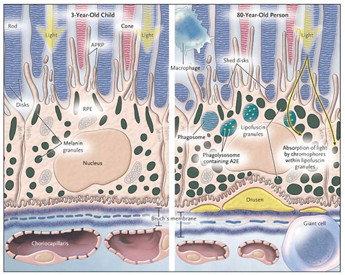 Cell Degeneration