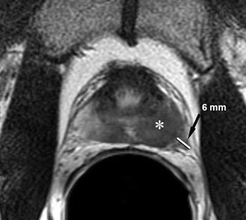 AsWe_MRI.jpg