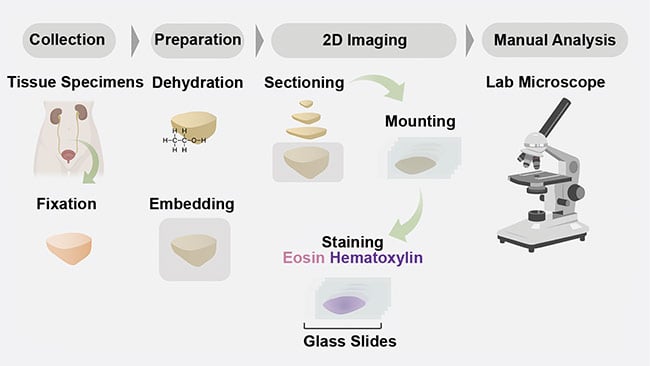 Figure 1. A schematic of a conventional 2D formalin-fixed paraffin-embedded hematoxylin and eosin (H&E) pathology workflow. Courtesy of A. Glaser/University of Washington Molecular Biophotonics Laboratory.