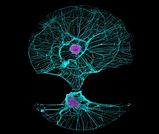 Fujifilm iCell Motor Neurons stained with Hoechst to identify nuclei (magenta) and with anti-Tuj1 to label neurites (cyan), imaged with a Yokogawa CQ1 automated microscope. Courtesy of Business Wire. 