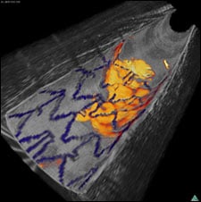 Arterial Structure