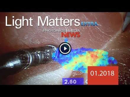 Light Matters Extra: Taking Photonics Innovations from the Lab to the Operating Room - 01.2018