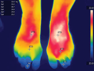 False-color thermal image with a microbolometer camera shows hotter (redder) and cooler (bluer)