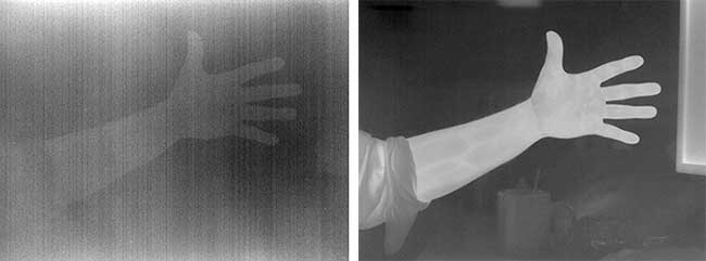 An LWIR image of a person’s arm before (left) and after (right) fixed-pattern noise correction. 