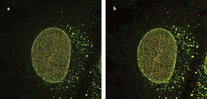 Challenges and Opportunities in Superresolution