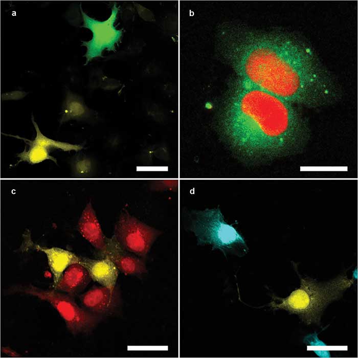 Fluorescence Microscopy Unravels Morphogenesis, Function of Lymph System