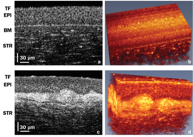 Advances in Optical Coherence Tomography