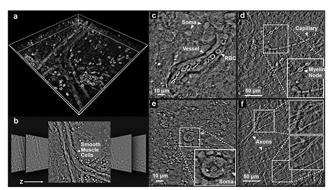 3D scattering microphantom sample to assess quantitative accuracy in  tomographic phase microscopy techniques