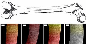 Researchers used a new endoscopic OCT system to visualize variances in pig cartilage thickness. The image shows a sketch of a femur and processed OCT images with thin regions shown in dark red and thicker regions more yellow and white. Scale bar is 250 µm. Courtesy of Evan T. Jelly, Duke University.