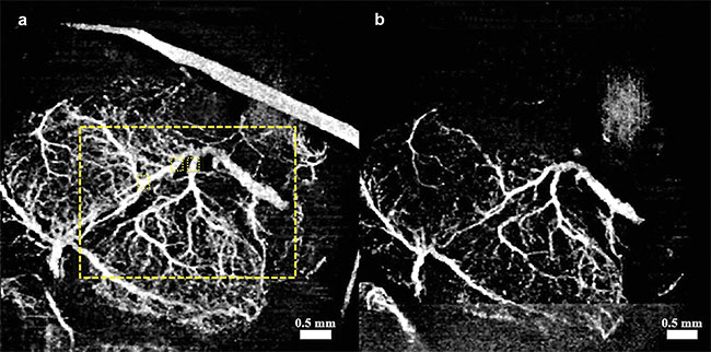 Figure 3. Vasculature changes in the embryonic brain before (a) and 45 min after (b) maternal exposure to synthetic cannabinoids (SCBs). Adapted with permission from Reference 12.