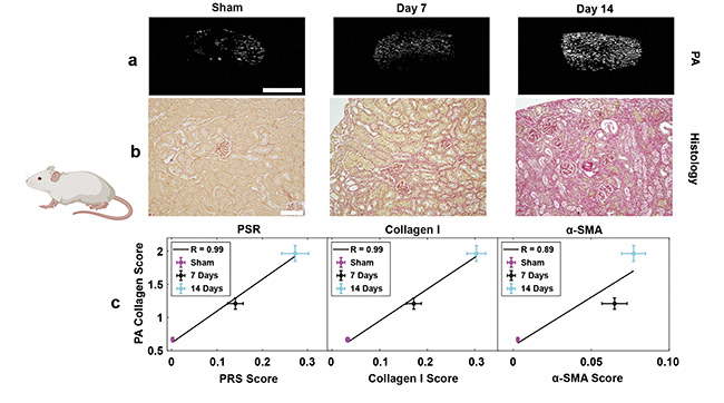Figure 2. Detecting kidney fibrosis in preclinical mouse models. Collagen maps of fibrosis generated for PA imaging (a) and picrosirius red (PSR) histology (b) as a function of days post-UUO (unilateral ureteral obstruction) surgery. Validation of the PA estimates of collagen against various gold-standard histological scores (c). PA scale bar = 2 mm; histology scale bar = 100 µm. SMA: smooth muscle actin. Adapted with permission from Reference 5.
