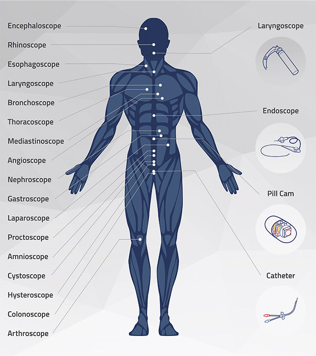 Different types of endoscopes target specific areas of the human body. Courtesy of OmniVision.