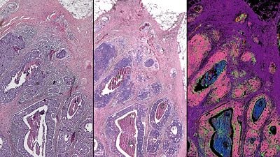 Hybrid Microscope Improves Tissue Pathology