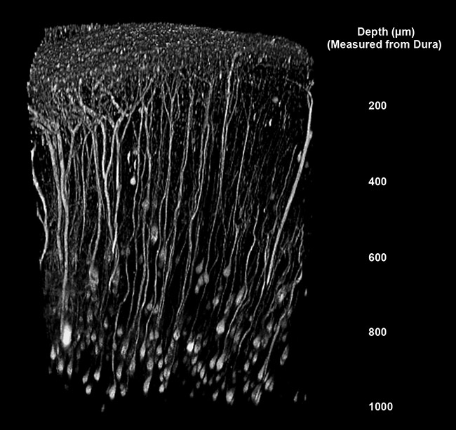 Figure 4. A two-photon image of mouse brain, showing details at 1-mm depths. Courtesy of Mario Merlini/Akassoglou Laboratory/Gladstone Institute of Neurological Disease.