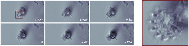 Figure 4. The beating cilia of a living rotifer. Six focal planes can be imaged simultaneously at 100 Hz without motion blur. Single-shot imaging of six focal planes (left). A zoomed-in view of the rotifer cilia (right). Courtesy of Sheng Xiao.