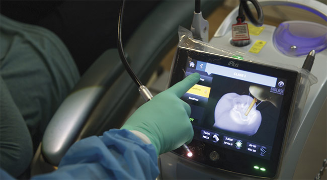 Clinicians track the progress of a laser dental treatment. Courtesy of BIOLASE.
