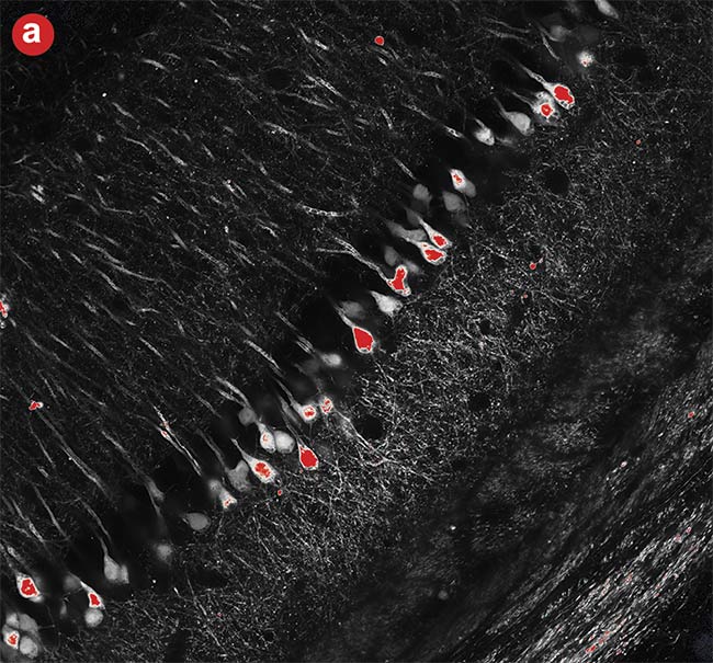 Figure 6. High dynamic range (HDR) imaging. A conventional photomultiplier tube (PMT) image in which the brighter neural cell bodies easily get saturated (a). An image captured using a silicon photomultiplier (SiPM) detector with advanced signal processing where both the cell body and neural fibers were in the detection range (b). Courtesy of Evident Scientific.