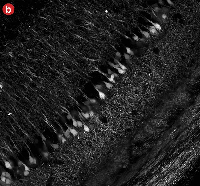 Figure 6. High dynamic range (HDR) imaging. A conventional photomultiplier tube (PMT) image in which the brighter neural cell bodies easily get saturated (a). An image captured using a silicon photomultiplier (SiPM) detector with advanced signal processing where both the cell body and neural fibers were in the detection range (b). Courtesy of Evident Scientific.