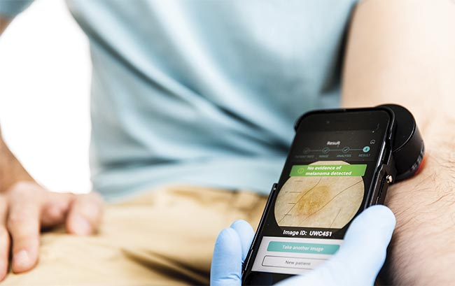 Figure 3. The Dermalyser uses a smartphone attached to a dermatoscope to detect potential melanoma. Courtesy of AI Medical Technology.