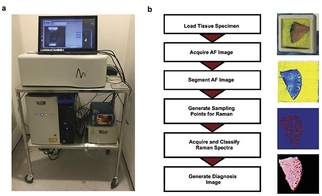 Figure 2. An autofluorescence-Raman instrument and measurement procedure. An autofluorescence-Raman instrument installed at the Nottingham University Hospitals NHS Treatment Centre (a). A flowchart of tissue processing and a measurement algorithm (b). AF: autofluorescence. Courtesy of the University of Nottingham.