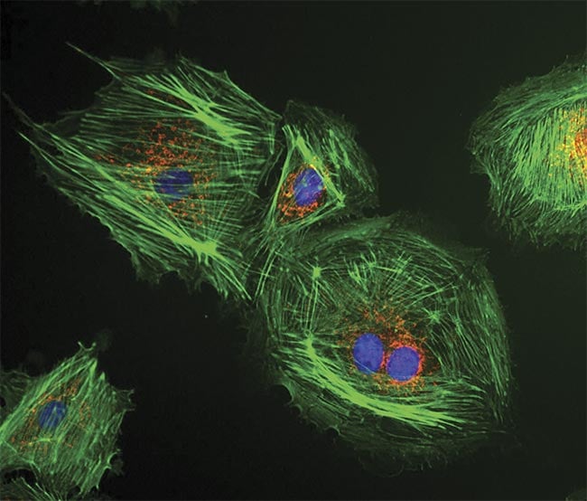 LED illumination excites the fluorescence from bovine pulmonary epithelial cells. Courtesy of CoolLED.