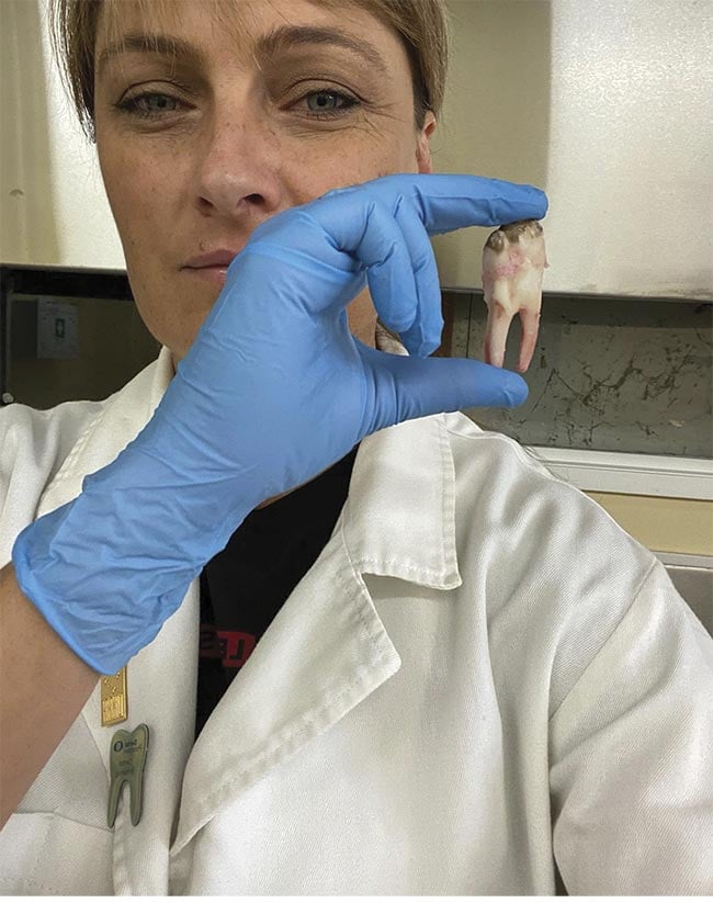 Figure 1. Liza Pretorius holding a bovine molar tooth (posterior tooth). Courtesy of Liza Pretorius/Central Queensland University.