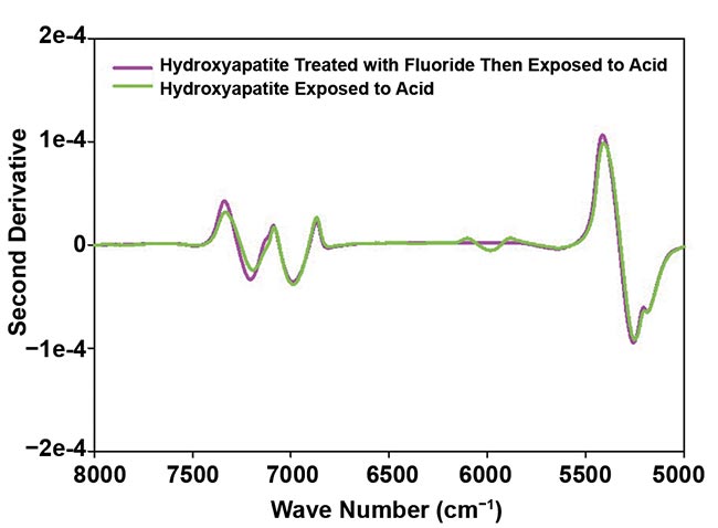 Figure 3. A second derivative of absorbance spectra of synthetic hydroxyapatite (HAp) treated with 22.6 mg/L fluoride and then exposed to an acid at pH 4.0 compared with HAp exposed to acid without a fluoride pretreatment (top); and second derivative of absorbance spectra of teeth treated with 22.6 mg/L fluoride and then exposed to an acid at pH 4.0 compared with teeth exposed to acid without a fluoride pretreatment (bottom). Courtesy of Liza Pretorius/Central Queensland University.