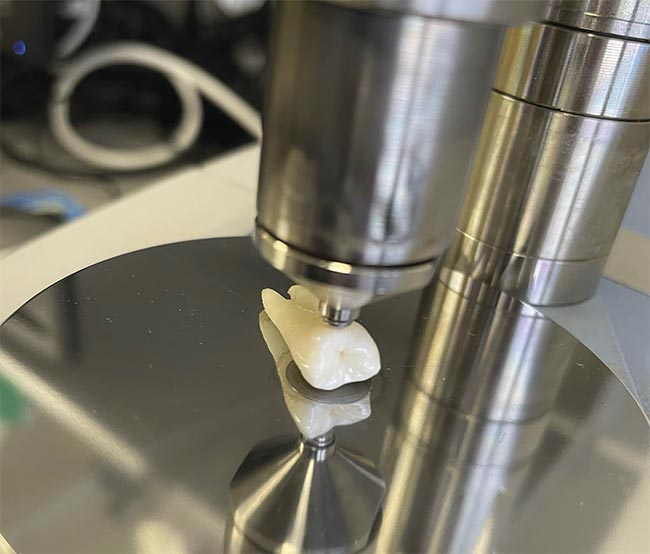 NIR spectroscopy analyzes the composition of a human premolar tooth at Central Queensland University in Australia. Courtesy of Liza Pretorius/Central Queensland University.