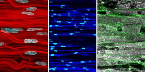 The image shows hydrogel scaffolds and cells that can be used to produce (from left to right) connective tissue, nerve tissue, and muscle tissue. Courtesy of ETH Zurich.