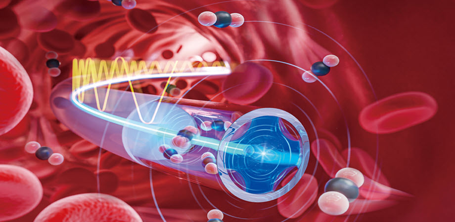 The fiber photoacoustic spectrometer (FPAS) enables continuous intravascular gas monitoring. Courtesy of Jun Ma/Jinan University.