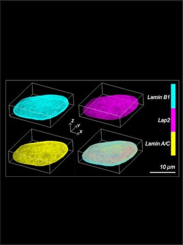 A sample image created by the soTILT3D microscopy system. Courtesy of the Gustavsson Lab/Rice University.