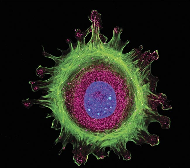 Immunofluorescence of a single human cell, grown in tissue culture, stained with multiple antibodies, and visualized via confocal microscopy. Courtesy of Edmund Optics.