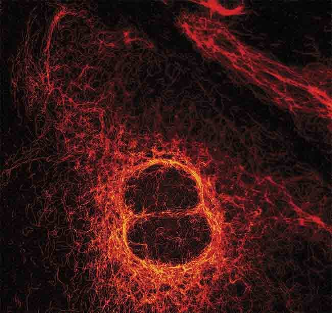 Figure 2. A stimulation emission depletion (STED) image of vimentin fibers, taken with the MicroTime 200. The fibers aid in the positioning and function of cellular organelles. Courtesy of PicoQuant.