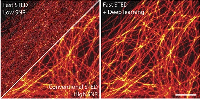 Figure 3. Deep learning enables fast and gentle stimulation emission depletion (STED) imaging. STED images of microtubules in a U2OS cell. Scale bar: 2 µm. Courtesy of Kyu Young Han/University of Central Florida.