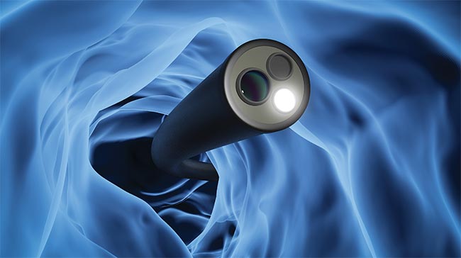 The current class of endoscopes requires high resolution in a compact form factor. Metalenses are a modern and increasingly popular solution to this and other requirements for designers. Courtesy of Ansys.