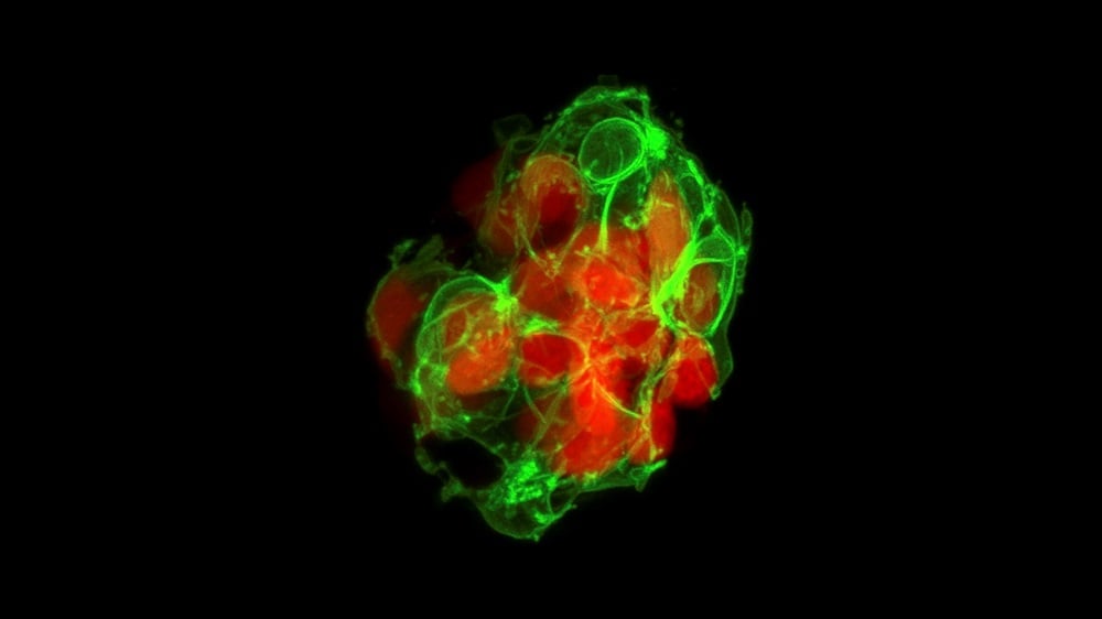 Beta cells from a zebrafish pancreas. The researchers used the transparent properties of zebrafish cells to track how blood sugar is regulated in a living being. Courtesy of Prateek Chawla. 