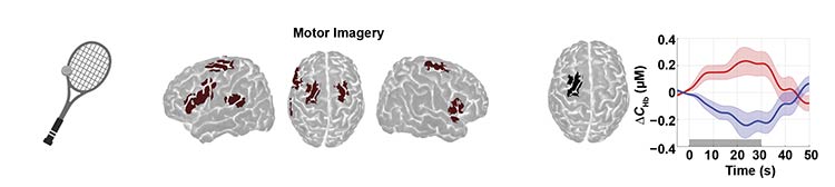 In one study, fNIRS was used to monitor brain activity in brain-injured patients instructed to imagine playing a game of tennis. The study provides evidence of preserved awareness despite no observable behavioral signs. Courtesy of Adrian Owen/University of Western Ontario.