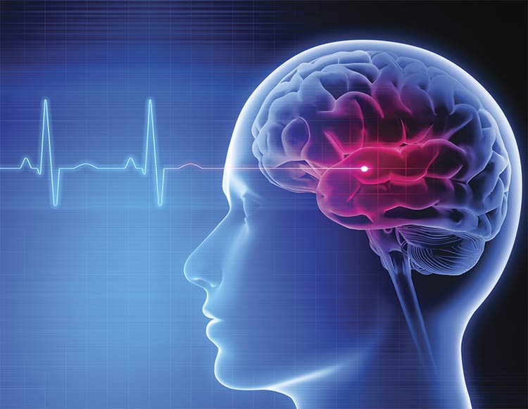 Tracking dynamic signals in the brain is a primary purpose of functional near-infrared spectroscopy (fNIRS), which can be used in conjunction with other modalities. Courtesy of iStock.com/peterschreiber.media.