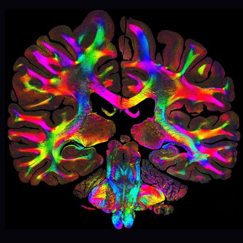Computational scattered light imaging (ComSLI) shows the orientation and organization of tissue fibers at µm resolution. The colors represent different fiber orientations. Courtesy of Stanford University/Marios Georgiadis. 