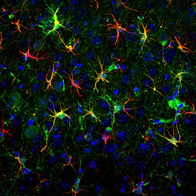 The image shows a section of the cerebral cortex, with astrocytes labeled in red, cell nuclei in blue, cells expressing DdPAC in green, and astrocytes expressing DdPAC in yellow. The latter are the cells activated in response to red light. Courtesy of the University of Barcelona.