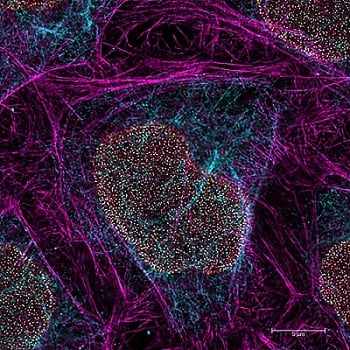 Super-resolution image of intracellular structures using a STELLARIS STED microscope and TauSTED Xtend. The magenta color shows actin filaments stained with ATOO 647N. Courtesy of Ludwig-Maximilians University Biomedical Centre/Mariano Gonzales Pisfil and Steffen Dietzel.