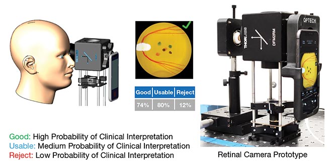 Figure 2. CCTT Optech’s retinal camera, featuring LED ring lighting and smartphone integration capabilities to yield high precision results. Courtesy of CCTT Optech.