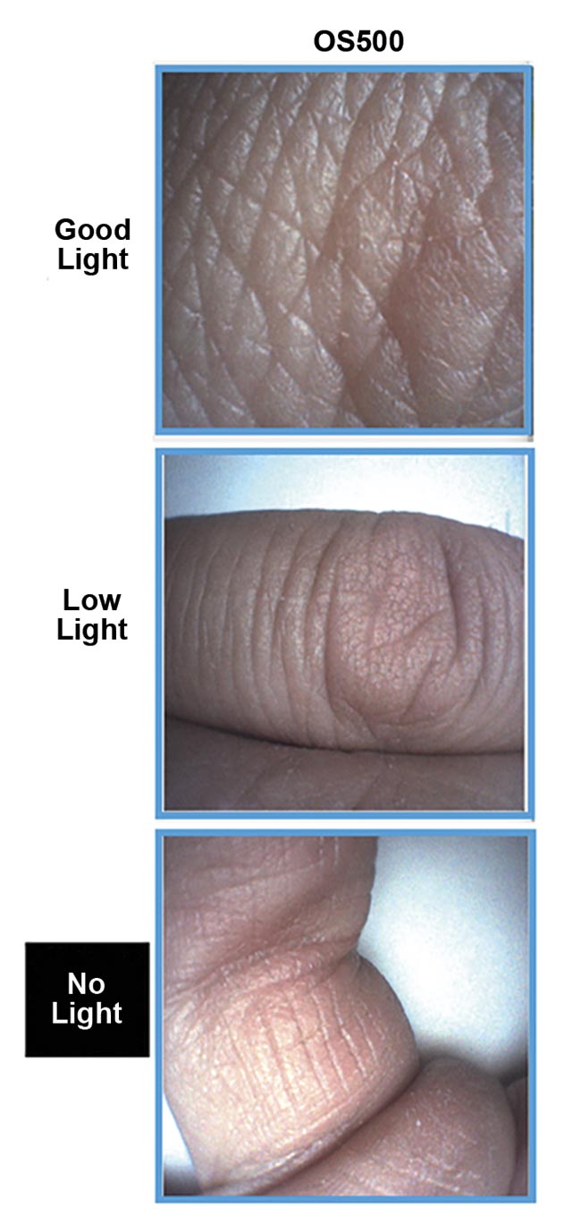 Figure 1. Examples of images obtained with the microcamera module OS500 for endoscopy applications. Courtesy of OptaSensor.