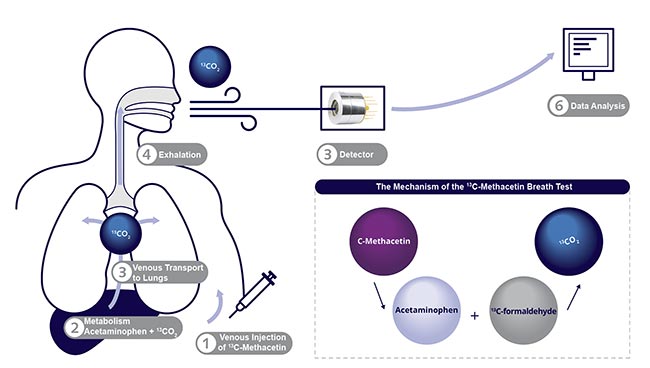 The principle of a 13C-methacetin breath test, which can serve as a warning of impaired liver function. Courtesy of VIGO Photonics.