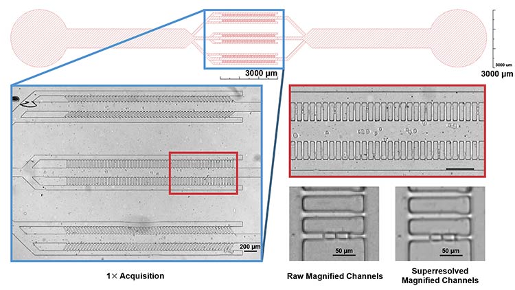The design of the microfluidic system. In the blue box (top), channels for trapping cells are shown. The iFLUOR system enables high-resolution 1:1 imaging of the channels (left). This resolution preserves a high level of detail even after magnification of the native image (red box, right). A superresolution algorithm further enhances image sharpness, as shown in the zoomed image of a single channel with two cells before and after superresolution algorithm application (bottom right). Courtesy of Simone Scalise and Mattia Miotto/Center for Life Nano- and Neuro-Science, Istituto Italiano di Tecnologia.