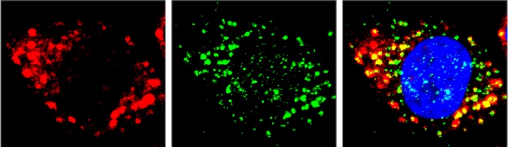 Stress granules (red) form when a cell is under stress. Photoselection of Transcriptome over Nanoscale (PHOTON) allows scientists to systematically identify RNA species (green) that are recruited into stress granules. The cell nucleus is stained blue. Courtesy of UT Southwestern Medical Center.