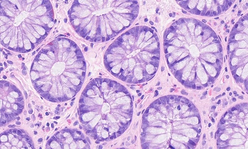 Image obtained using Pramana’s volumetric imaging technology, which utilizes real-time AI algorithms to provide whole slide imaging. Courtesy of Evident.