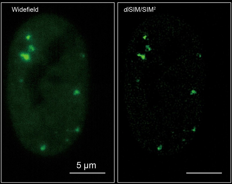 Full nuclei exhibiting DNA damage, marked by green, cloud-like 53BP1 foci. Courtesy of Queen Mary University of London.