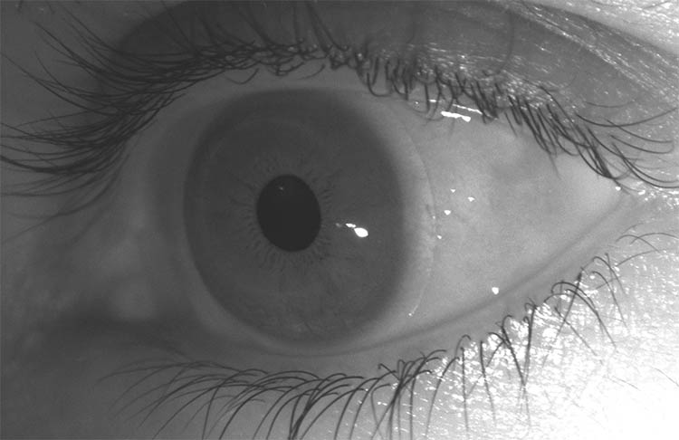 The human eye’s function could provide clues to make a hyperspectral imaging system more effective. Courtesy of ORCA Med.